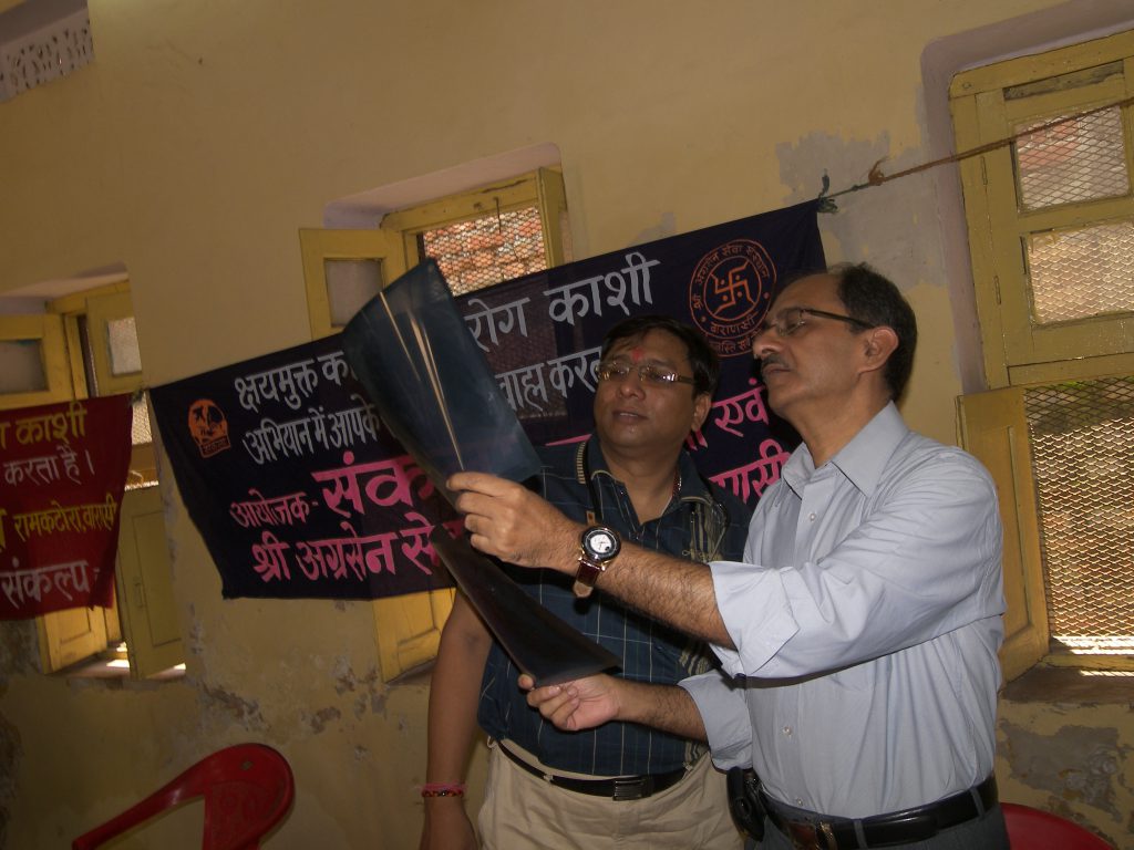 Dr. Amit Johri & Dr. Anurag Agrawal in TB Camp.